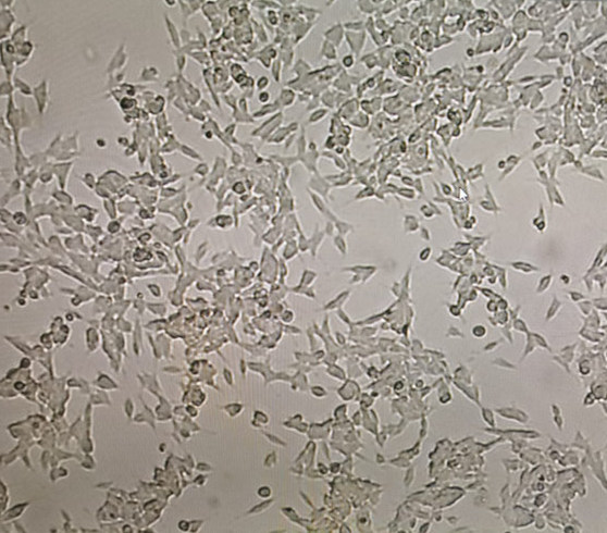 1637546442786629.jpg SH-SY5Y处理后第三天