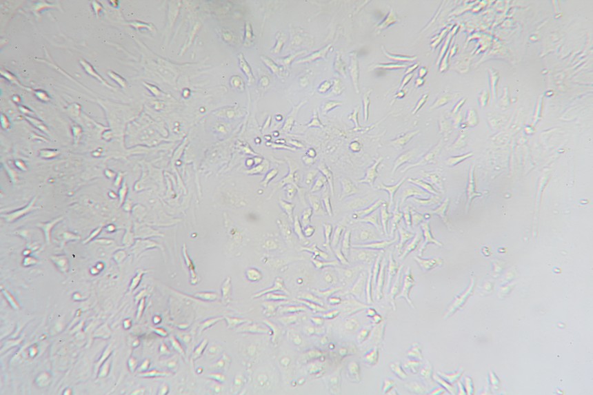 【细胞分离】大鼠骨髓间充质干细胞的分离培养