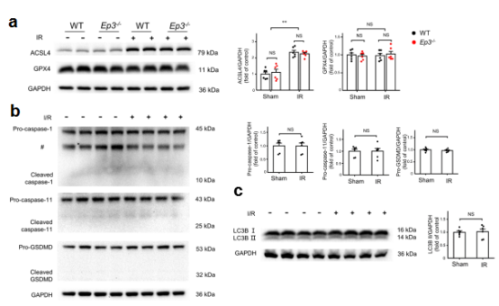 急性肾损伤发病机制