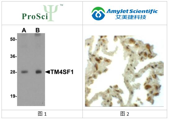 艾美捷ProSci丨ProSci TM4SF1 抗体解决方案
