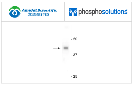 PhosphoSolutions抗eIF4A2抗体解决方案 PhosphoSolutions抗eIF4A2抗体解决方案