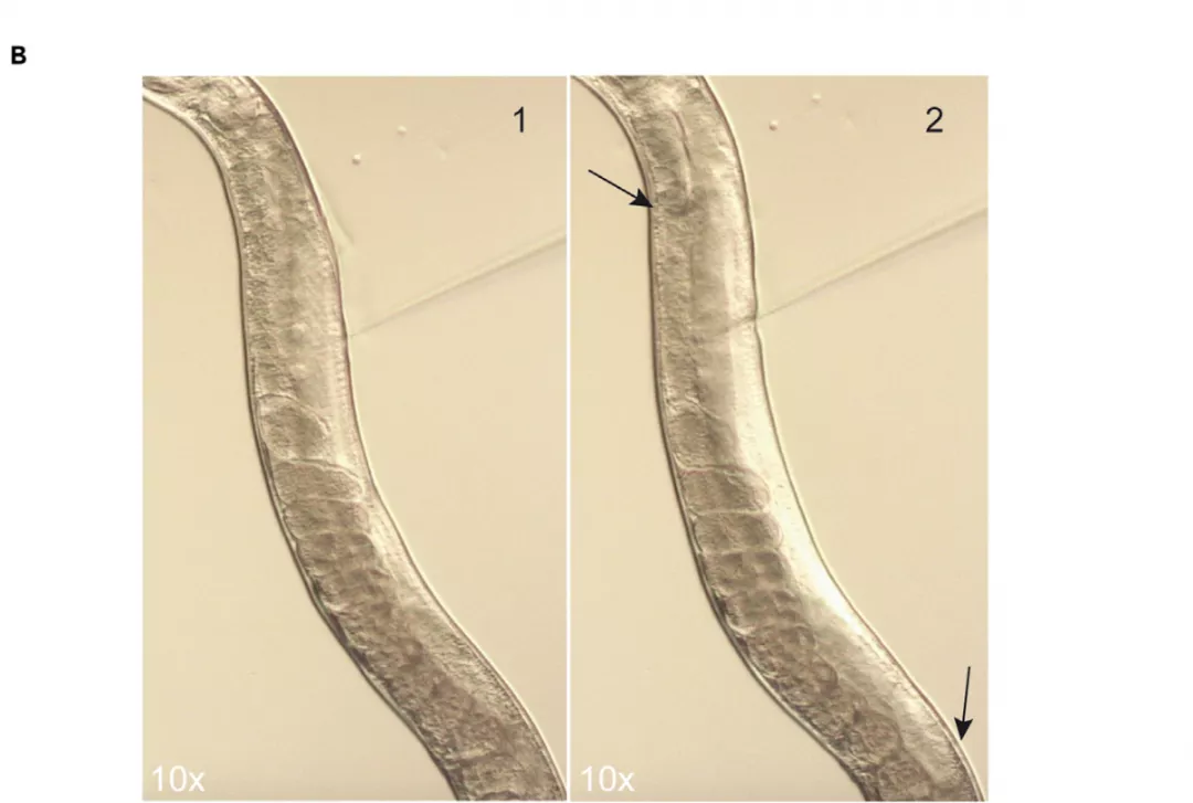 线虫显微注射如何操作？超详细实验步骤快来码住