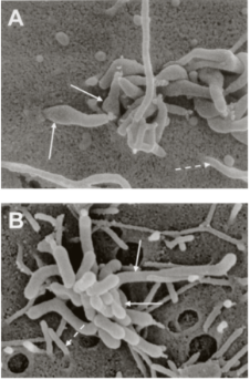 什么时候应检测支原体