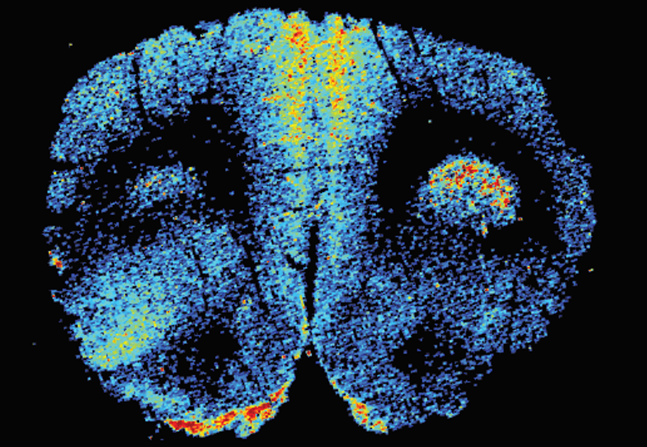 激光剥蚀 — 电感耦合等离子体质谱元素成像技术
