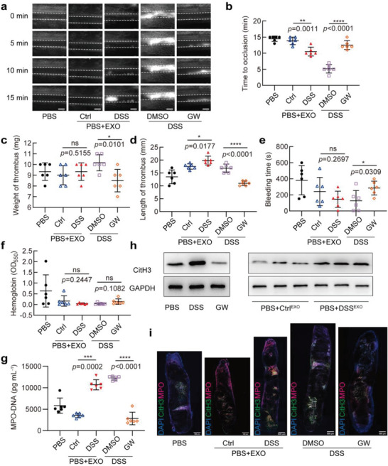 外泌体提取鉴定 外泌体提取鉴定