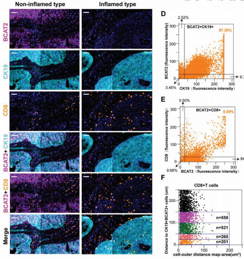 多色文献分享：BCAT2联合ICB——膀胱癌诊疗新思路