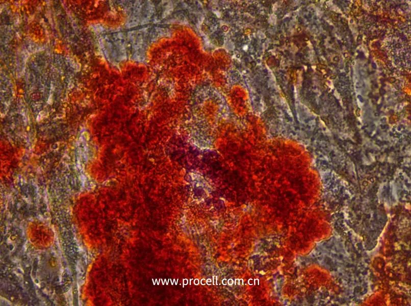 638211363517009138492.jpg 638211363517009138492.jpg