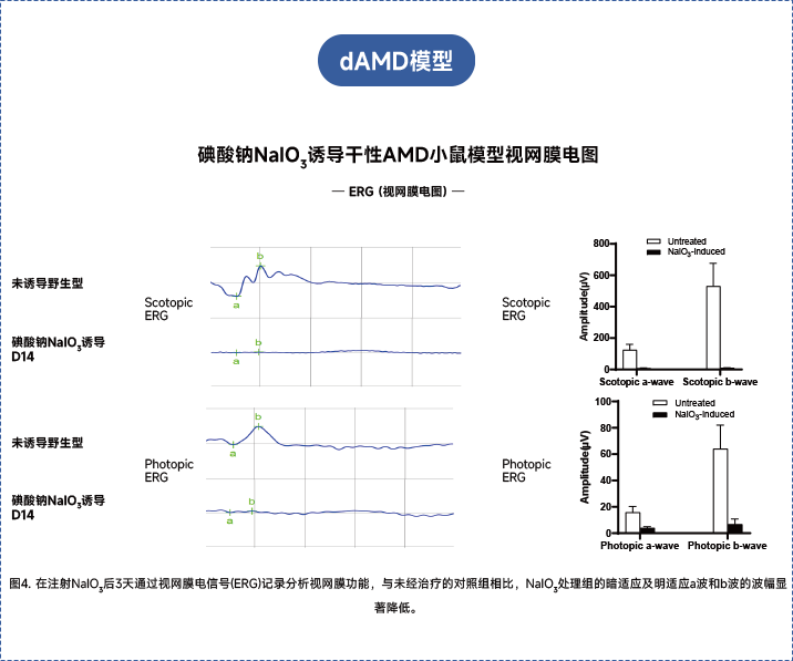 年龄相关性黄斑变性