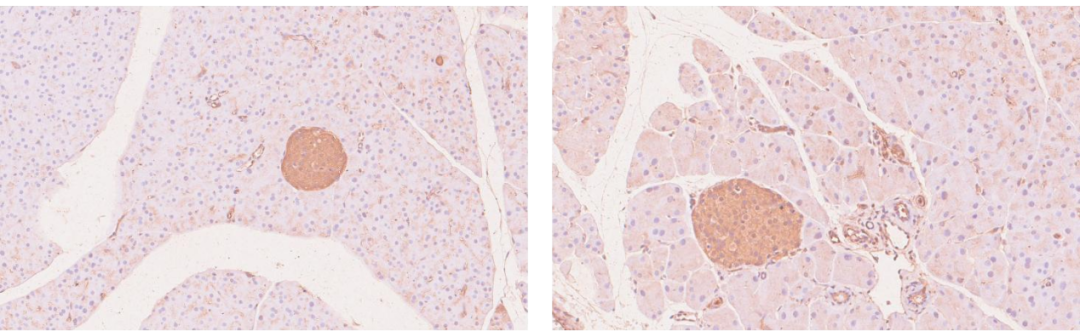 hGLP1R全人源化小鼠模型
