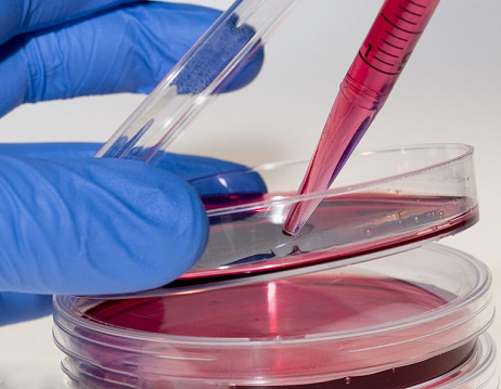 NK细胞采用因子体外培养的方法