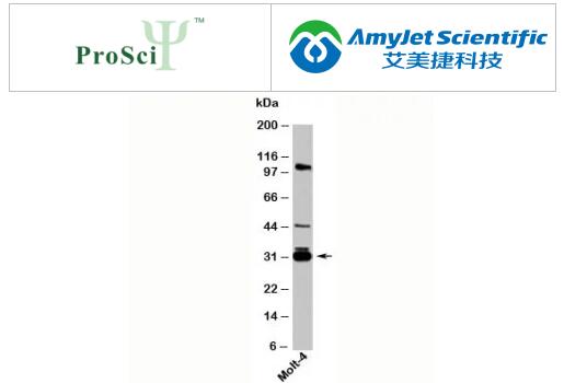 多克隆抗体丨ProSci 14-3-3 sigma 抗体说明书 多克隆抗体丨ProSci 14-3-3 sigma 抗体说明书
