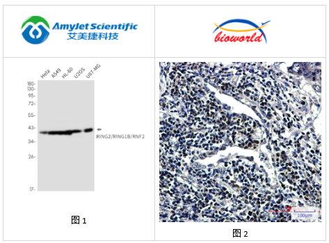艾美捷Bioworld RING2单克隆抗体解决方案