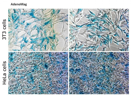 艾美捷 AdenoMag转染试剂的特点和应用介绍