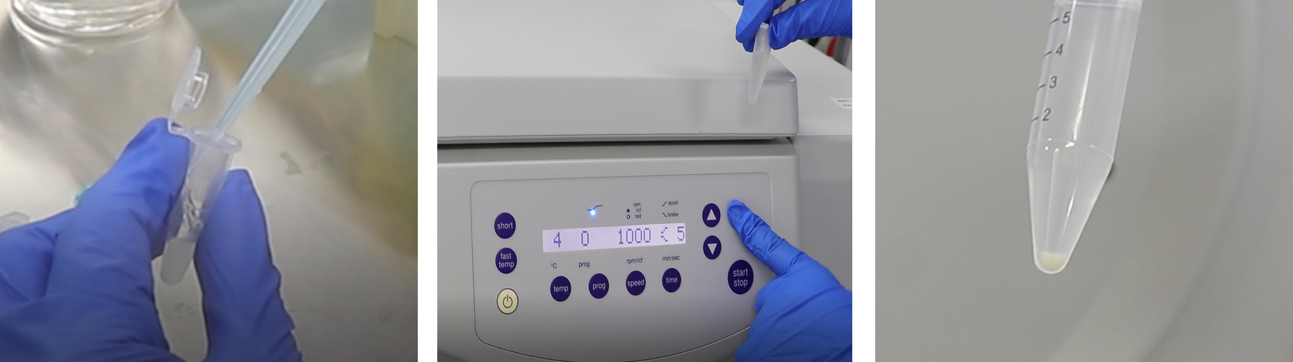 类器官包埋及HE染色实验方法