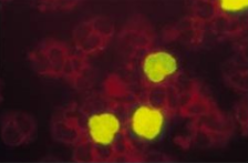 IQ Products CMV Brite Turbo试剂盒的原理