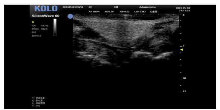 小动物成像检测有哪些?可以对应哪些指标?