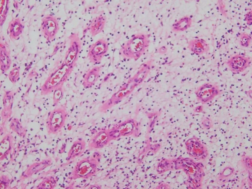 切片学习 | 常规病理组织切片及诊断要点