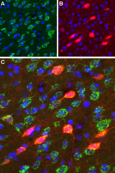 多巴胺受体在生物体内的分布