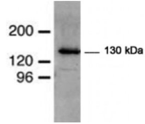 模式生物果蝇抗体丨E3 泛素蛋白连接酶(MIB) 抗体 模式生物果蝇抗体丨E3 泛素蛋白连接酶(MIB) 抗体