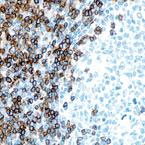 CD3单克隆抗体应用方案 CD3单克隆抗体应用方案