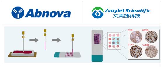 Abnova ProteoScreen - 组织微阵列抗体详解