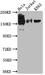 Epigentek-STAG2重组单克隆抗体[3H4]：开启科研省钱模式