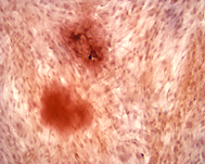 MSC细胞成骨诱导与茜素红染色