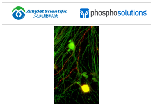 PhosphoSolutions抗降钙素基因相关肽 (CGRP) 抗体方案 PhosphoSolutions抗降钙素基因相关肽 (CGRP) 抗体方案