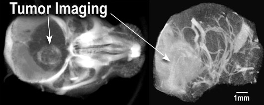 艾美捷AuroVist-15nm——新型的X射线造影剂 艾美捷AuroVist-15nm——新型的X射线造影剂