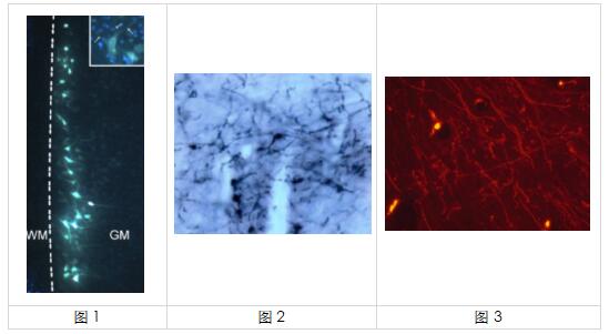 神经元逆行/顺行示踪：艾美捷Fluorochorome方案