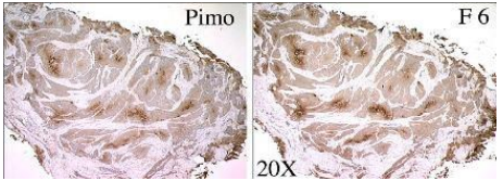 Hypoxyprobe-F6 (CCI-103F)促销到年底~ Hypoxyprobe-F6 (CCI-103F)促销到年底~