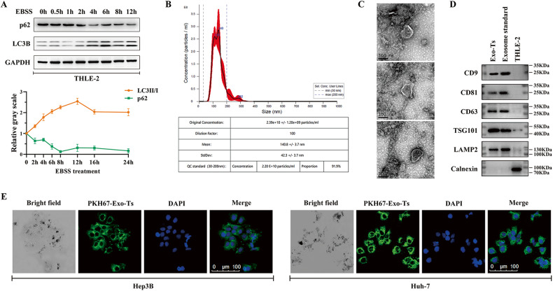 外泌体和细胞自噬