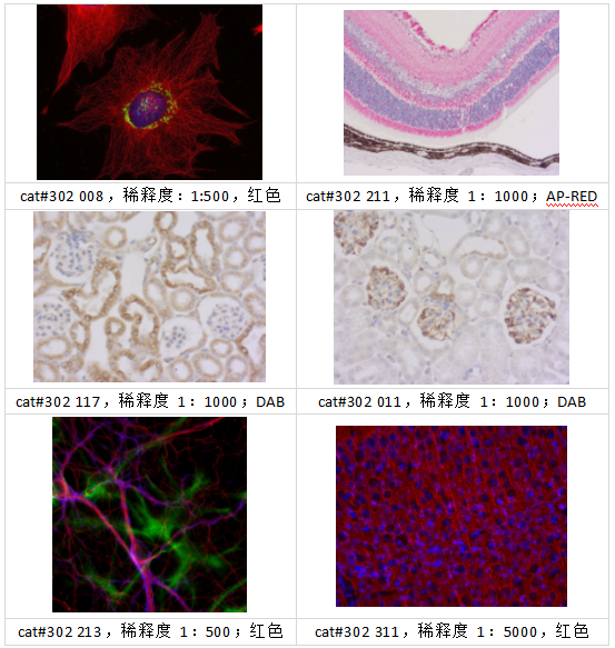 拿高分文章，还得是Synaptic Systems 微管蛋白抗体