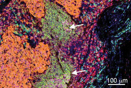 B细胞可能为开发针对某些癌症的新疗法提供机会