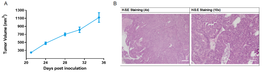 如何选择合适的肿瘤模型？