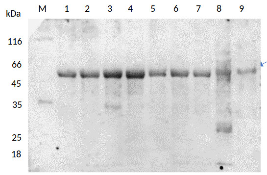 Tubulin alpha and gamma are not suitable as a loading control for metal stress