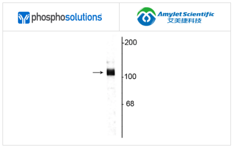 艾美捷Phosphosolutions抗淀粉样蛋白前体蛋白抗体方案