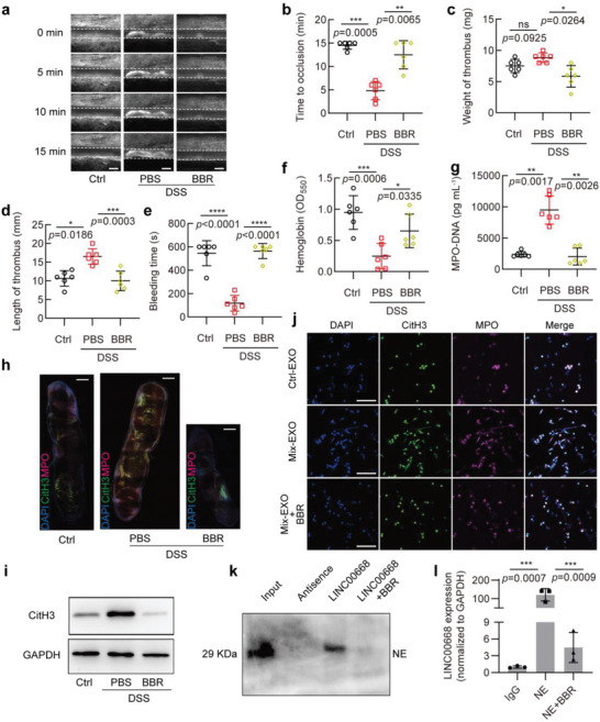 外泌体提取鉴定 外泌体提取鉴定