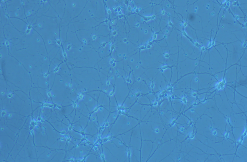 胎鼠海马神经元的原代培养