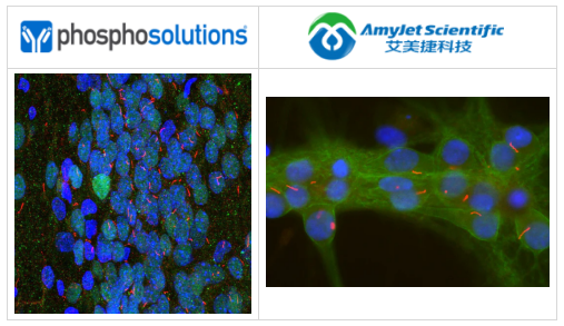 PhosphoSolutions抗腺苷酸环化酶III抗体解决方案 PhosphoSolutions抗腺苷酸环化酶III抗体解决方案