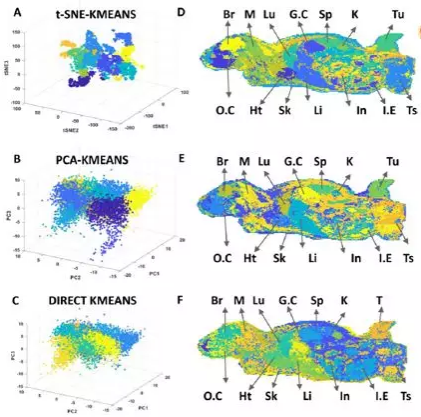 空间代谢组学实现异质性生物组织中待测物准确定量质谱成像
