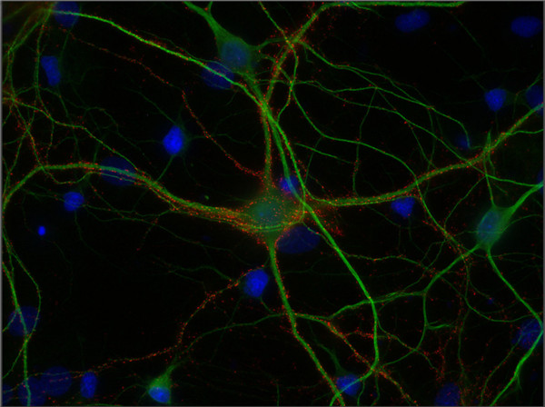 Bassoon 染色结果图