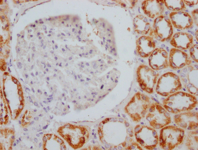 Epigentek-AIFM1重组单克隆抗体[4B2]：抢购热潮来啦