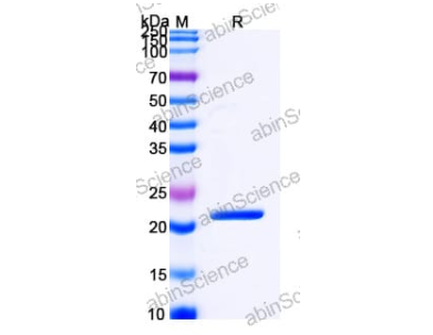 abinscience重组小鼠白血病病毒包膜蛋白，助力科研新突破