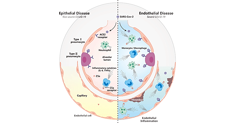 C5AR1：补体系统潜力分子，有望助力新型冠状病毒（COVID-19）治疗！