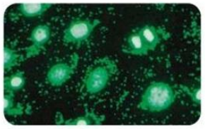 养细胞不做冤大头，3分钟帮你搞定支原体污染