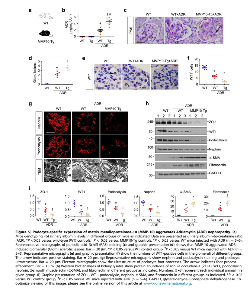 MMP10加重ADR模型足细胞损伤 