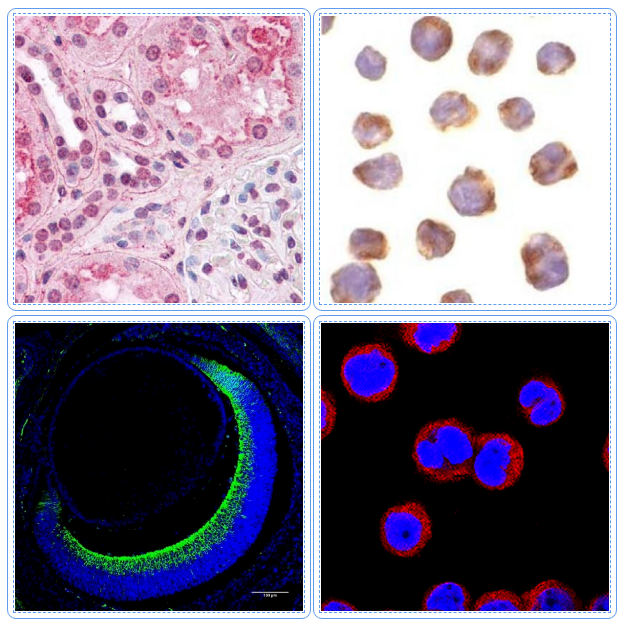 Bio-techne|IHC/ICC/IF 抗体哪家强？适用范围早知道