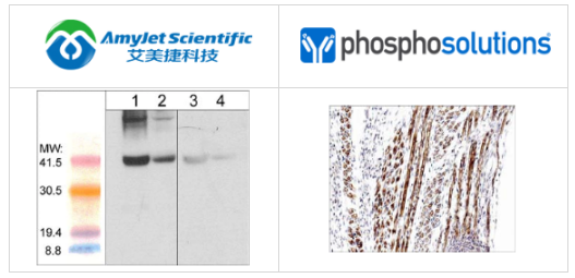 PhosphoSolutions抗阿罗蛋白-1抗体解决方案 PhosphoSolutions抗阿罗蛋白-1抗体解决方案
