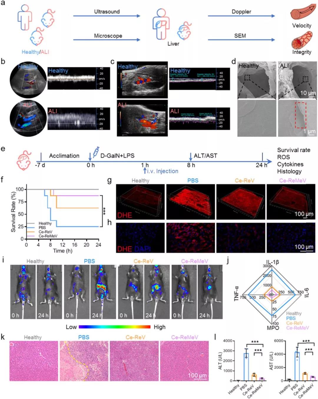 文献解读|细胞囊泡原位生长抗氧化纳米晶用于高效清除活性氧和急性炎症性疾病的治疗